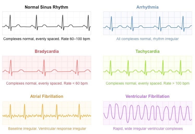 Wellue Blood Pressure Monitor and ECG is an affordable option to monitor your heart health 2